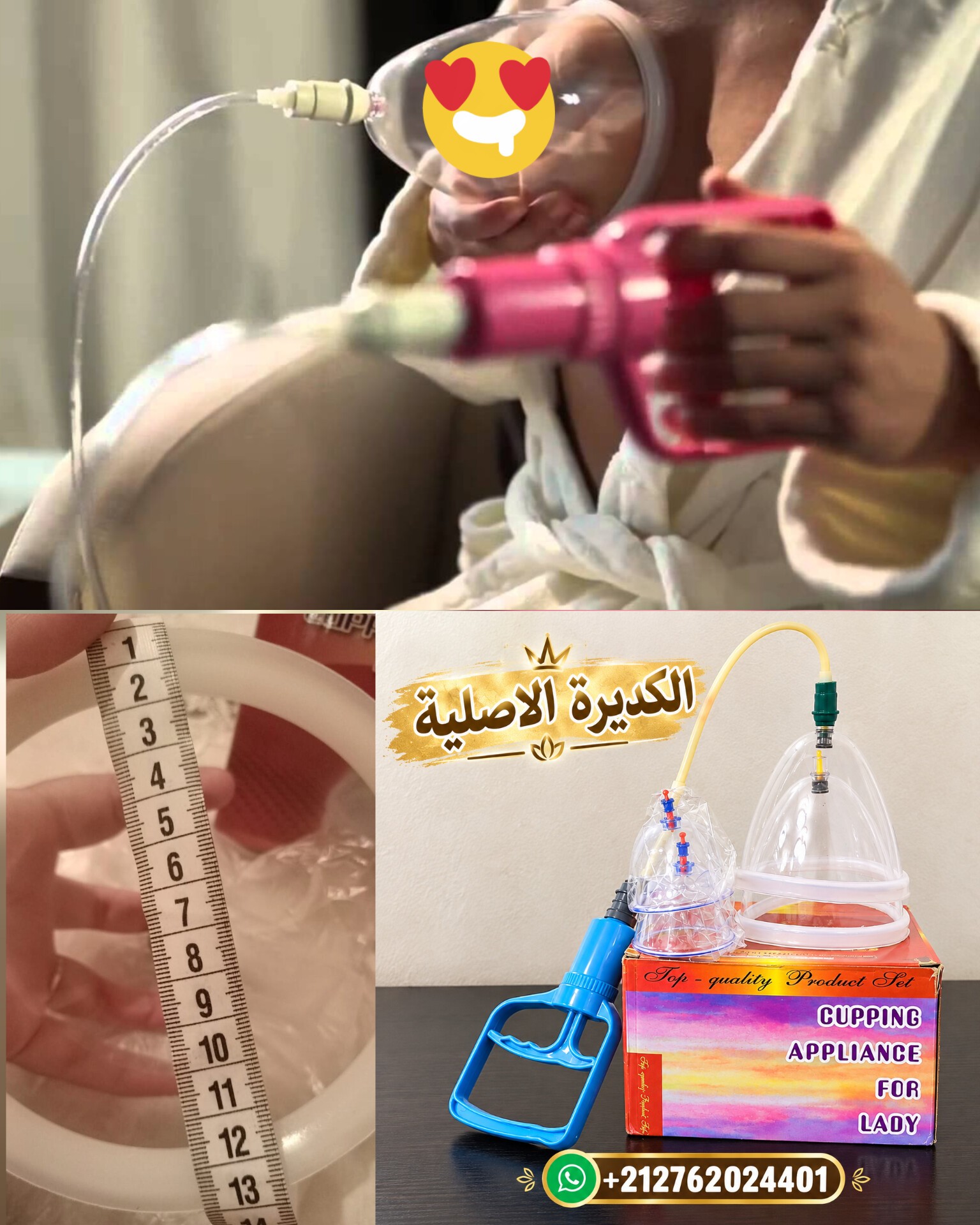 الكديرة العصرية الأصلية cupping vacuum  4